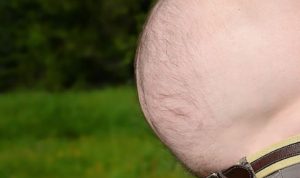 Perut Buncit Perut Buncit Hilang, Lakukan Hal Ini